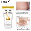 Cellulite Removal Treatment Cream