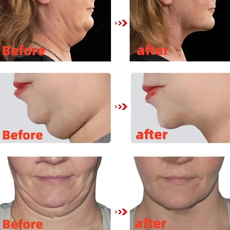 V Shape Slimming Cream