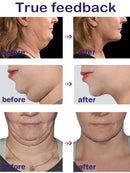 Effective  Face Slimming Lifting