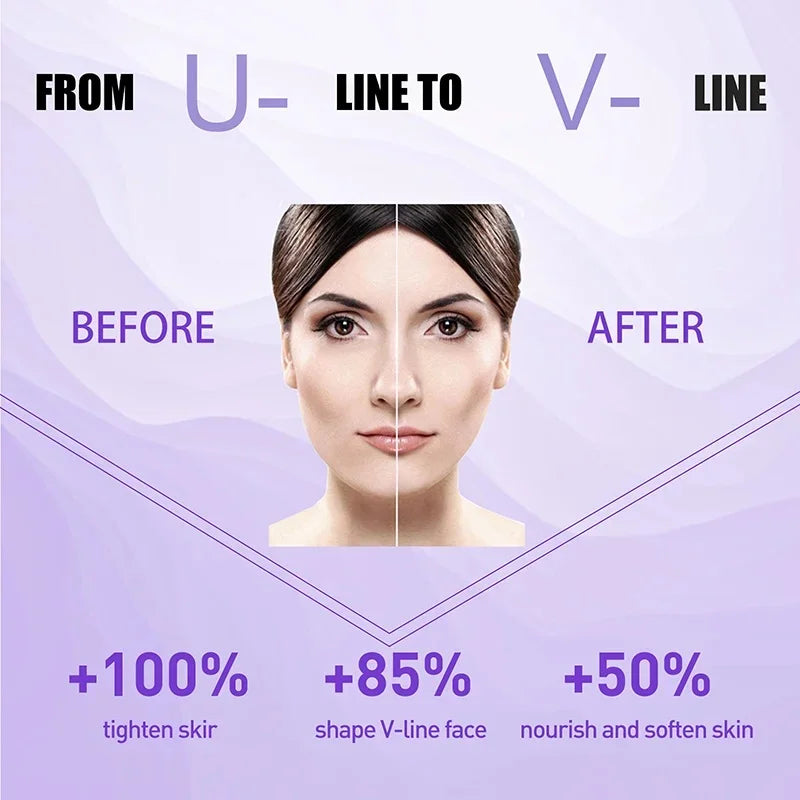 V Shape Slimming Cream