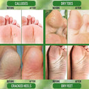 Herbal Anti Crack Foot Cream