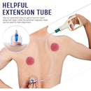 Suction pieces 6 or 24